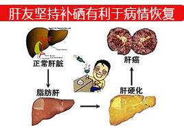 肝友堅持補硒有利于病情恢復(fù)