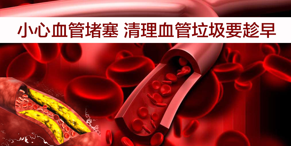 當(dāng)心！這幾類人群血管最易堵，適當(dāng)補(bǔ)硒遠(yuǎn)離血管疾病