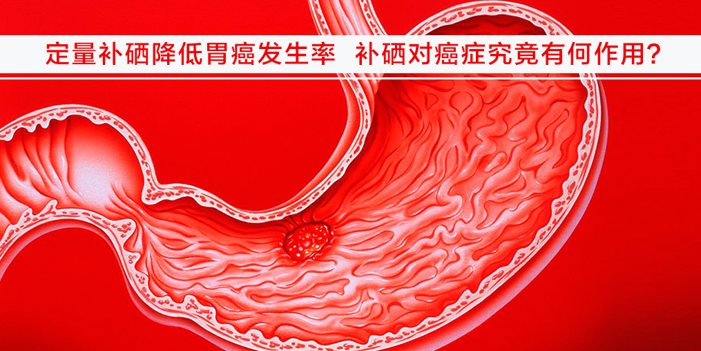 遠(yuǎn)離胃癌不難，改變不良習(xí)慣外多補(bǔ)硒