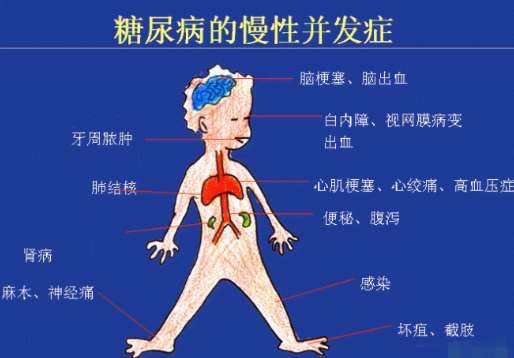 你還在害怕糖尿病嗎？科學(xué)補硒不“恐糖”