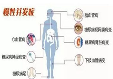 遠離高血糖并發(fā)癥，請記住一點，學(xué)會“補硒”