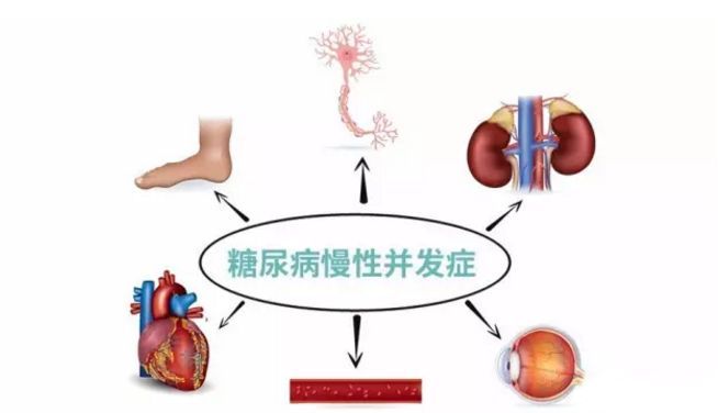 血糖波動大，并發(fā)癥來得快，糖友要多補硒